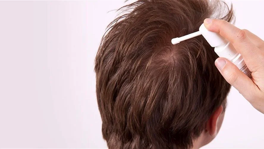 Minoxidil 5% Spray Repousse des cheveux homme Femme, 1 bouteille 60ml + Dermaroller professionnel